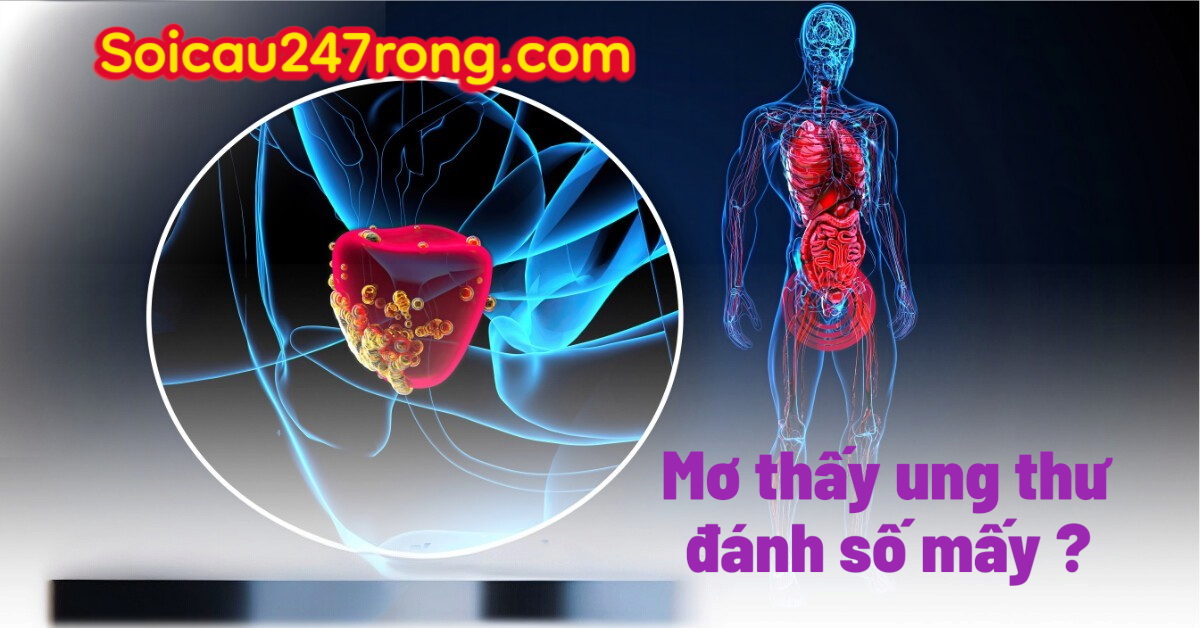 Mơ thấy ung thư đánh lô gì ? Sổ mơ lô đề chuẩn nhất